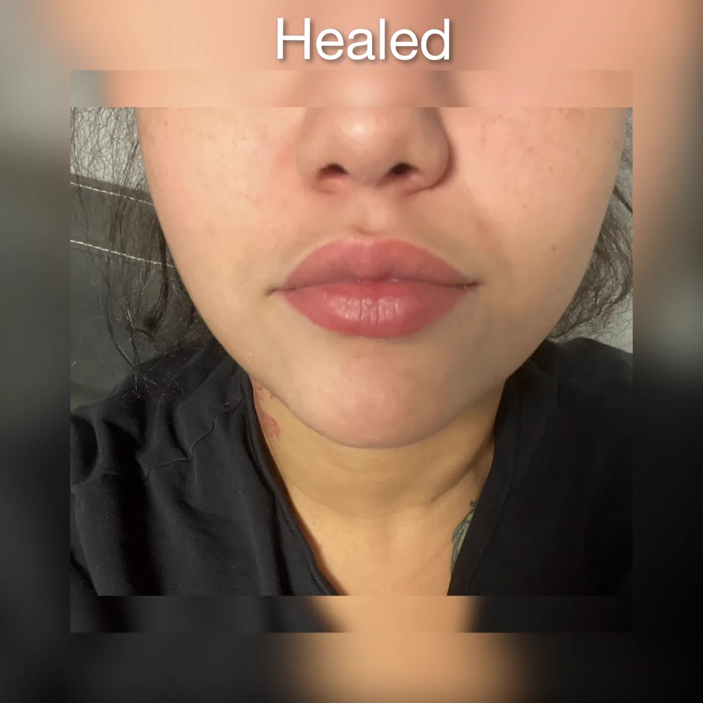 Lips, healed by Lupita Arreola at DeVi Beauty Studio in Colorado Springs